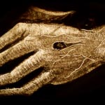 Stigmatisierte Hand Vorschau